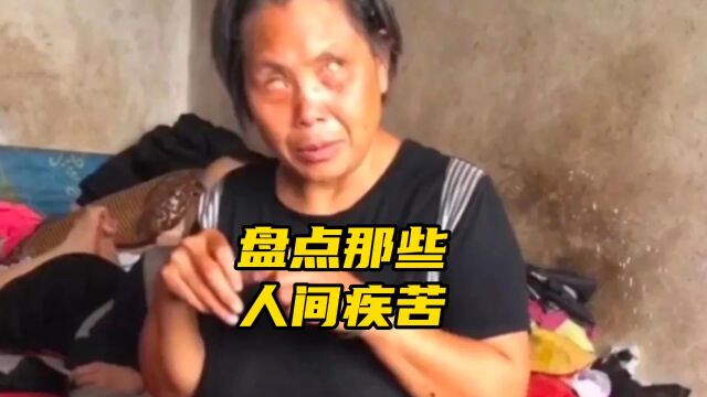 盘点那些人间疾苦