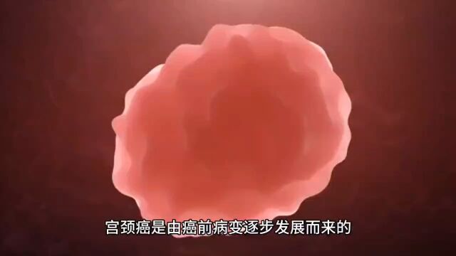 HPV是怎么形成的