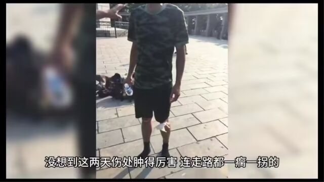 《感人故事》无腿也能走出精彩人生