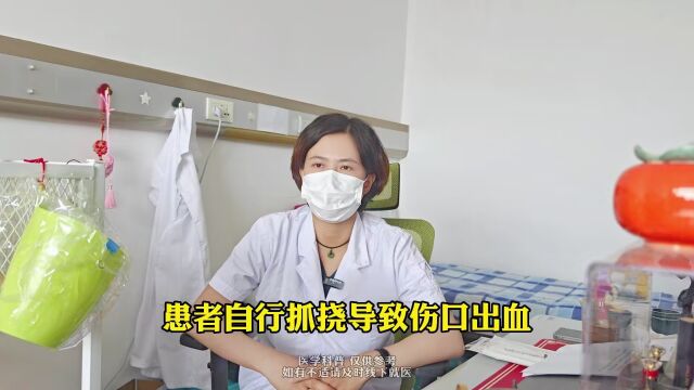 光动力治疗尖锐湿疣效果好吗?医生:3点优势很明显