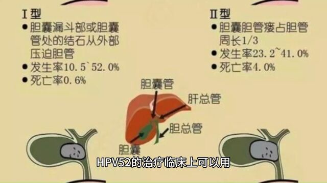 hpv52怎么治疗才转阴南京家和医院