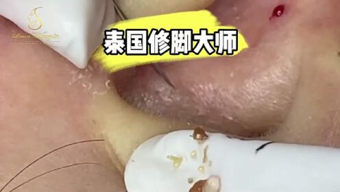 腾讯视频