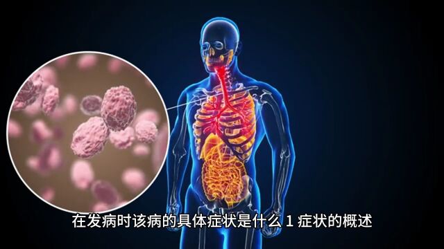 腓总神经损害的发病症状是什么?