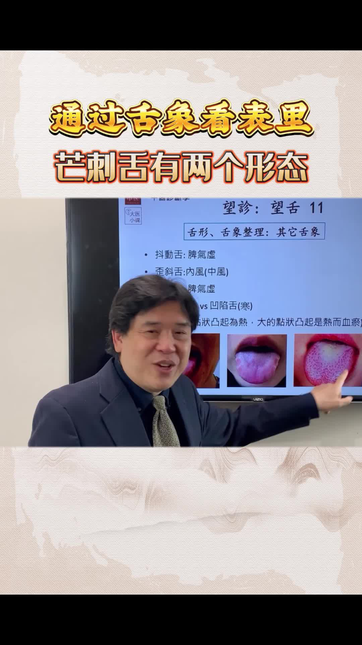 芒刺舌有两个形态