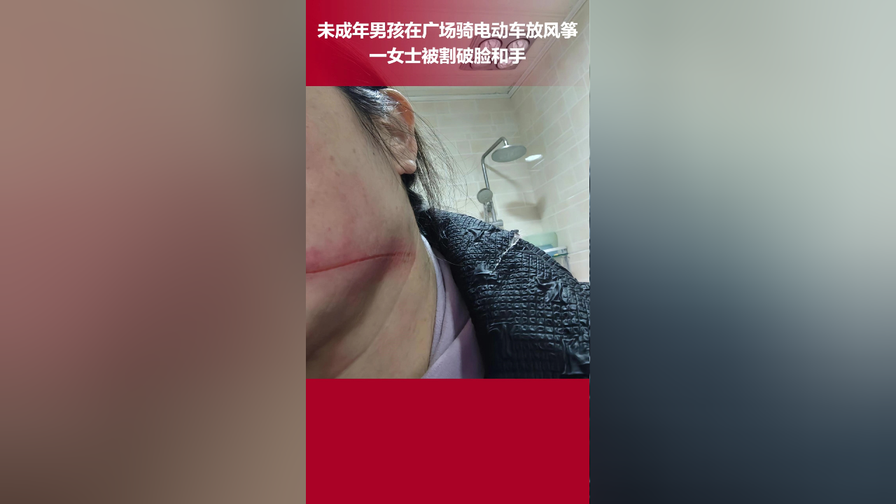 未成年男孩在公园骑电动车放风筝,一名女士被风筝线割破脸出血,目前已